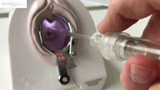 Demo of IUD Insertion with ASPIVIX R D
