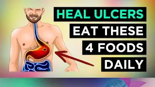 4 Foods To HEAL Stomach Ulcers Eat These Everyday