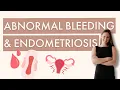 Abnormal Bleeding Endometriosis Why It Happens and How to Fix It