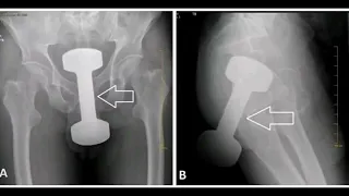 دمبل ٢ ٥ ك اللي دخل غلط أغرب حالة دخلت الطوارئ 