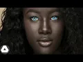 10 Rarest Black People Who are 1 in a Million