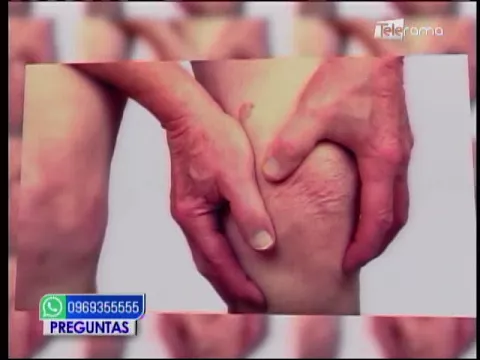 Causas de la artritis