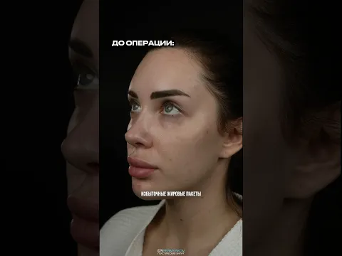 Хирургия без швов 🔥 Доктор ПЕРМЯКОВ В.Н.
