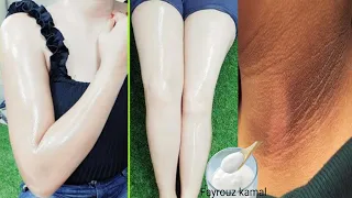 Starch And Vinegar By God Then By God The Body Will Be Bleached Forever 