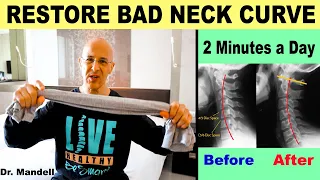Restore Your Bad Neck Curve Super Fast Dr Alan Mandell DC