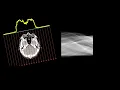 X-ray tomography sinogram build-up