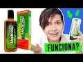 DOES MEDICASP WORK GETTING RID OF DANDRUFF