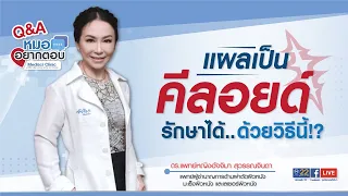  แผลเป็นที่เกิดขึ้นหลังการผ่าตัดเปลือกตา มีลักษณะอย่างไร และเกิดจากสาเหตุอะไรบ้าง 