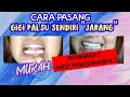 Download Lagu cara memperbaiki gigi palsu yang ompong jadi rapih