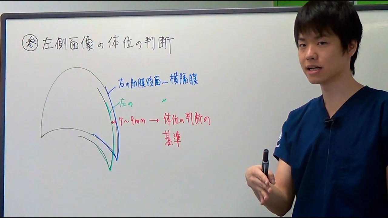 01.胸部レントゲンをはじめからていねいに【総論1】- 米内竜の迷走録