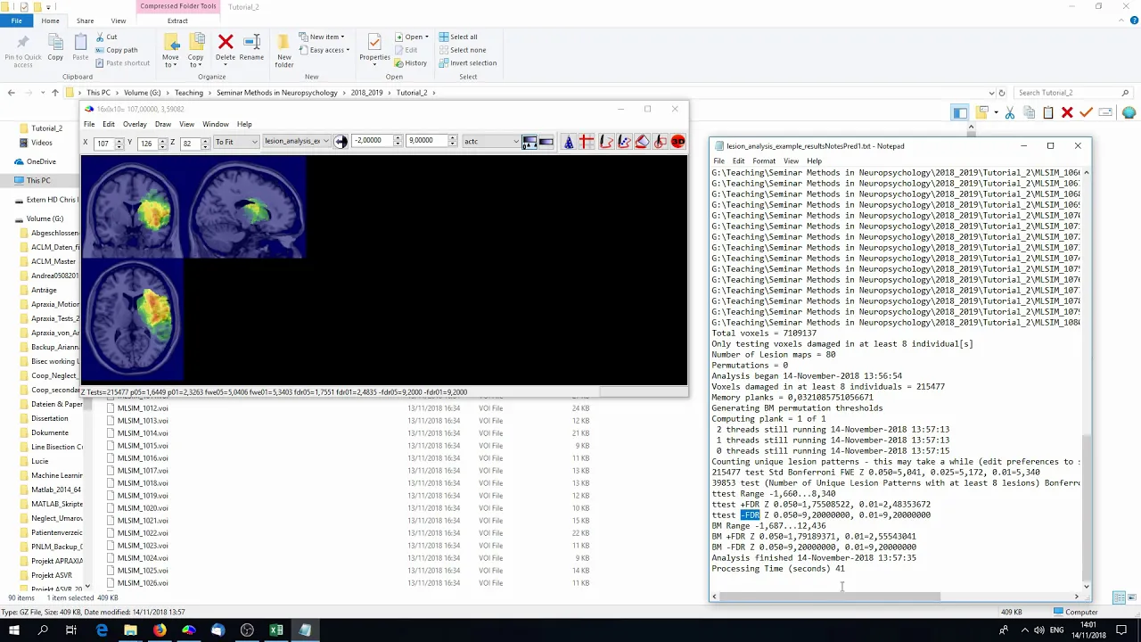 Methods in Neuropsychology Tübingen - Tutorial 2 Voxel-based statistical lesion symptom mapping