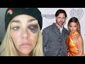 Denise Richards Accuses Ex Aaron Phypers of Abuse Granted Restraining Order
