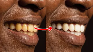 Photoshop Tip to whiten teeth & eyes
