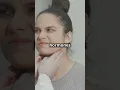 Graves Disease Explained in 60 Seconds