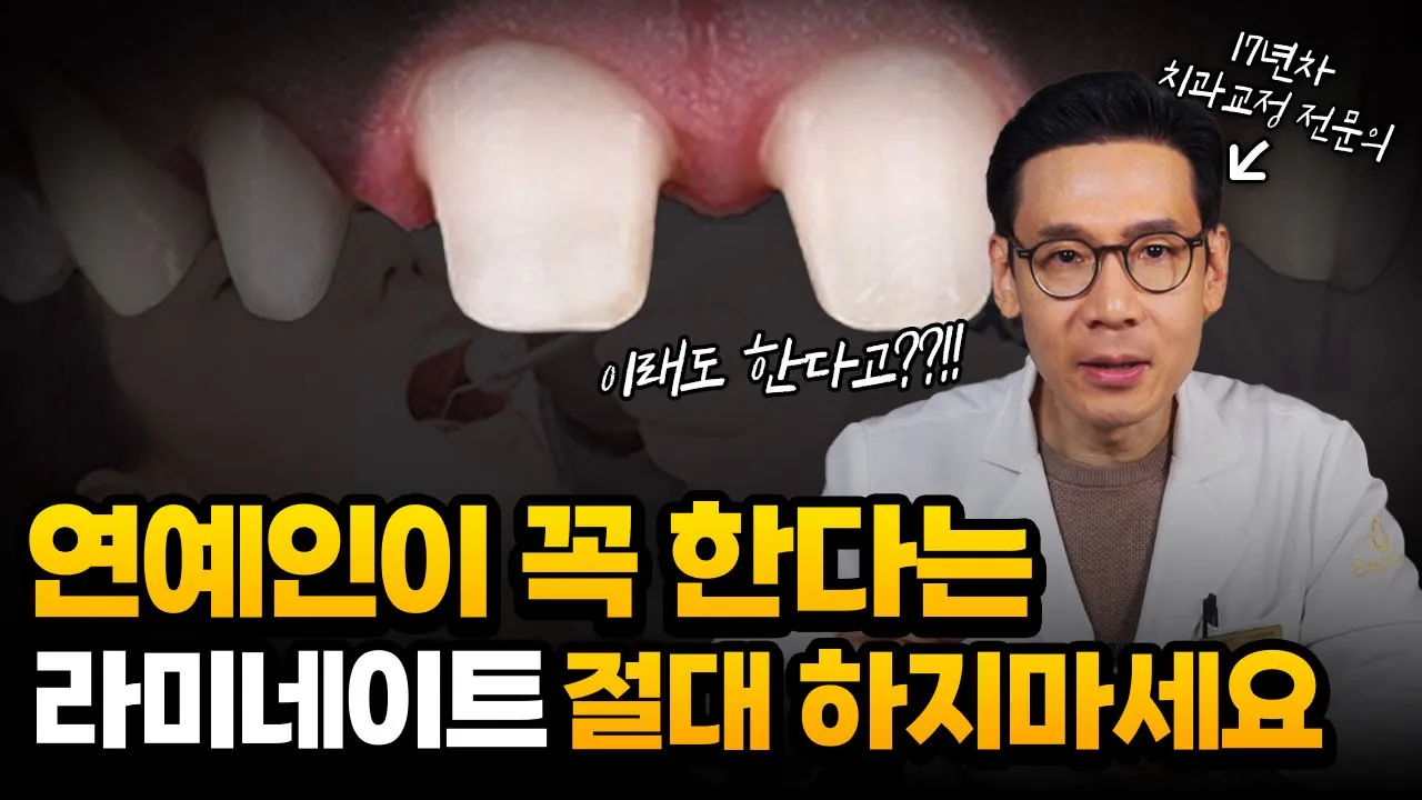연예인들이 한다는 라미네이트, 이 경우엔 절대 하지 마세요!