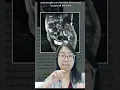Download Lagu What happens to the *space* where the uterus was after a HYSTERECTOMY? Gynecologist Explains! #short