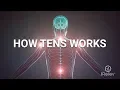 How a TENS Unit Works