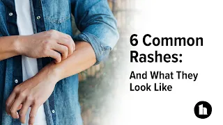 6 Common Rashes And What They Look Like Healthline