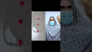 ماذا لو كانت الحجية دكتورة اسنان كوميدي سوري كوميدي عراقي جيش الششمه Funny جيش الششمه 