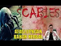 Lagu SCABIES..................... ATASI DENGAN MENGGUNAKAN BAHAN HERBAL