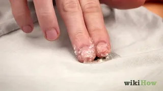 How to Remove Sap from Clothes