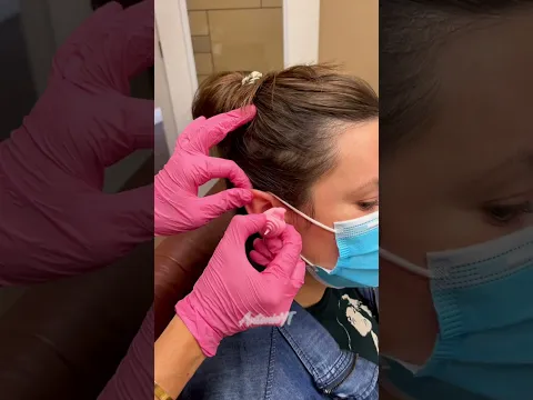 ¡EL LÍQUIDO MISTERIOSO que los médicos ponen en el oído! 👂💧😱
