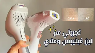 تجربتي مع ليزر ملاي وفيليبس   ومقارنة بينهم بالتفاصيل المهمة وبالصور   دندنها