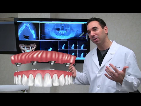 Download MP3 All on 4 Dental Implants Explained