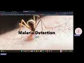 Malaria cell detection Using Deep learning and flask
