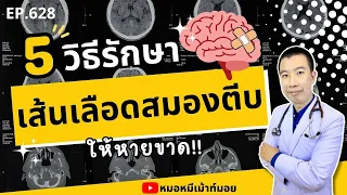 อะไรคือสาเหตุหลักที่ทำให้เกิดเส้นเลือดในสมองตีบ?