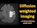 Download Lagu Diffusion Weighted Imaging (DWI) in Neuroradiology... made easy!