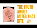 The Truth About Mites that Bite With Examples