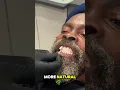 Is it possible to add a real diamond to your implant