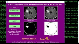 Python Code On Brain Tumor Detection Using CNN Convolutional Neural Network Python Source Code