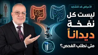 علامات وجود ديدان في القولون: لا تتجاهل هذه الأعراض!