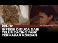 Download Lagu Fakta-fakta Balita di Sukabumi Meninggal Akibat Cacingan | AKIP tvOne