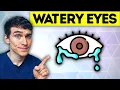 Lagu The #1 Best Watery Eyes Remedy (causes and treatment) - Eye Doctor Explains