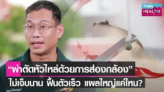 อาการปวดหัวไหล่ในนักกีฬาเทนนิสเกิดจากสาเหตุอะไรบ้าง