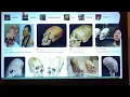 Ancient Elongated-Skull People are More Mysterious Than We Have Realised