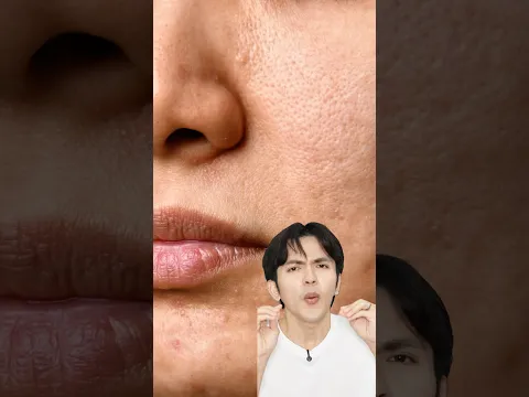 Serum for enlarged pores