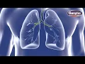 Benylin Wet Cough Starts to Work quickly