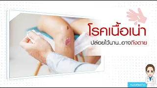อาการของโรคเนื้อตายจากเชื้อแบคทีเรียที่รุนแรงมีอะไรบ้าง?