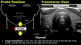 Thyroid Ultrasound Probe Positioning Transducer Placement Scanning Technique USG