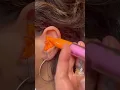 Download Lagu It’s #earimpression #compilation time 🤩 #satisfying #audiology #rochesterny #asmr #hearingloss