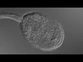 Download Lagu Cercaria (Tremadote larva)