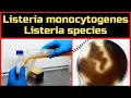 Lagu Detection of Listeria monocytogenes \u0026 Listeria species_Complete Procedure (ISO 11290-1 \u0026 BAM, Ch-10)