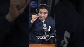 Monkey rips part of guys scalp off