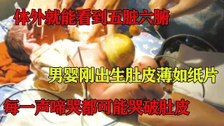 体外就能看到五脏六腑,男婴刚出生肚皮薄如纸片,每一声啼哭都可能哭破肚皮#真相