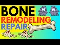 Bone Remodelling and Repair - A Simple Introduction