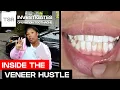 Undercover at a Fake Veneer School You Won t Believe What We Found TSR Investigates